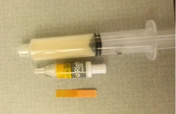 A syringe filled with aspirate from a patient's stomach, comparing the difference between regular pH paper and RightBio Metrics' RightSpotpH Indicator for confirming NG tube placement in the stomach