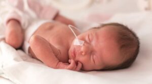 infant lies on bed with tube in nose